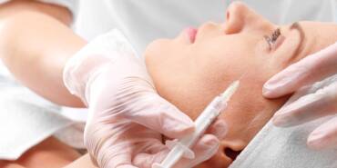 Best Botox for crow's feet