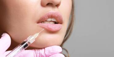 reduce lip filler swelling