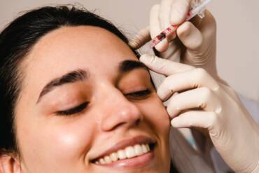 Can I Work Out After Botox? And 7 Other Commonly Asked Questions