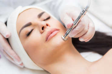 Microdermabrasion Cost in Falls Church