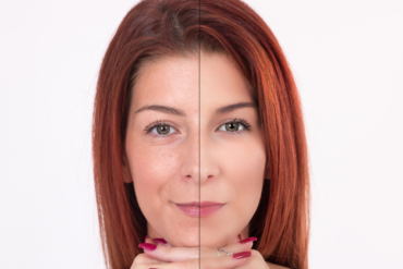 Best Skin Rejuvenation Specialist in Great Falls, VA