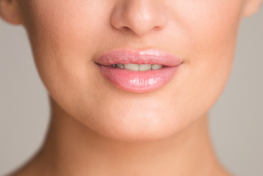 Same-Day & Next-Day Dermal Filler Options in Falls Church