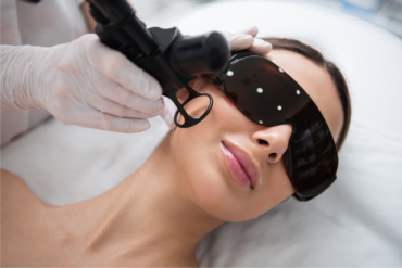 Best Laser Skin Rejuvenation Treatments for Youthful Glow in Arlington, Virginia