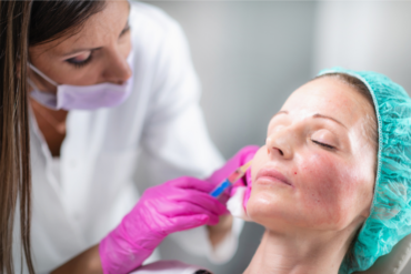 How Much Does Sculptra Cost in Falls Church, Virginia?