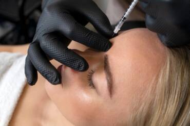 Why Botox Is the Go-To Solution for Wrinkle Reduction in Fairfax and Reston, VA