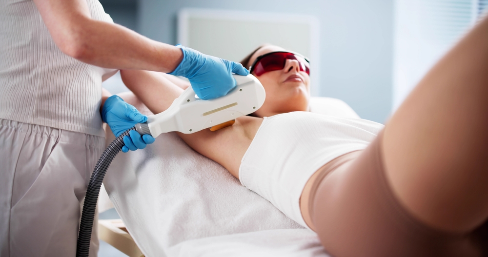 Laser Hair Removal Fairfax VA
