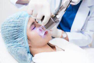 Navigating the Skin Resurfacing Treatment Cost in Alexandria, Virginia