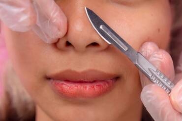 Expert Dermaplaning Facials Near Merrifield