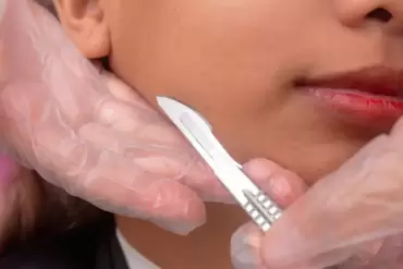 Dermaplaning in McLean, VA: Smoother, Brighter Skin Explained