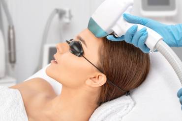 CoolPeel Skin Renewal and Fine Line Reduction Near Annandale Virginia
