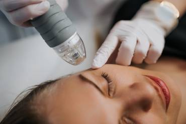 Radiofrequency and Laser Facelift Treatments Near McLean, Virginia