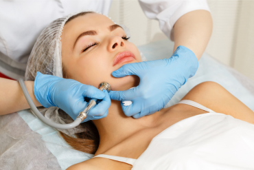 Microdermabrasion Near Reston, Virginia
