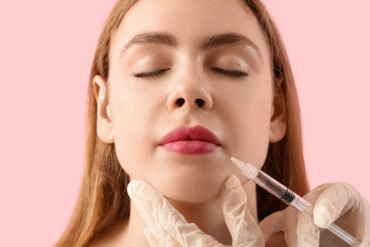 Lip Filler for Facial Balancing Appointment in McLean Virginia
