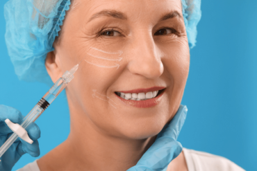 Under Eye Filler Treatment for Dark Circles in McLean Virginia