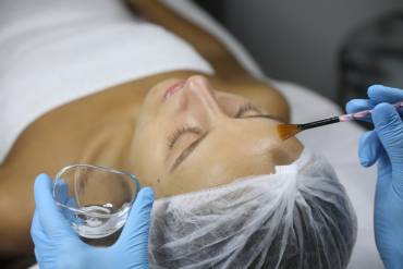Chemical Peel Appointment Near Me in Northern Virginia for Acne and Hyperpigmentation