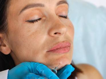 Chin Filler Treatment in Northern Virginia for Profile Balancing