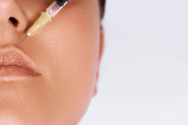Best Lip Filler Treatment for Natural Looking Results in Vienna Virginia