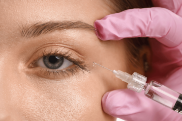 Botox Appointment for Crow's Feet in Vienna Virginia