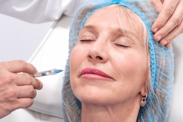 Lip Augmentation Appointment for First Time Patients in Fairfax Virginia