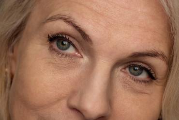 Non-Surgical Nose Job Near Tysons Corner Virginia: Filler Rhinoplasty Results