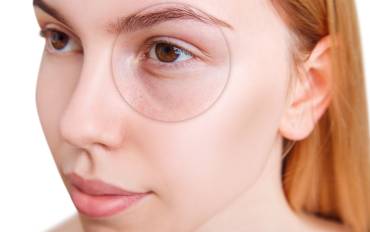 Under Eye Filler Near Reston, Virginia For Dark Circles And Hollows