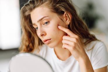 What Are the Top Same-Day Acne Facials in Falls Church, VA for Breakout Relief and Clearer Skin?