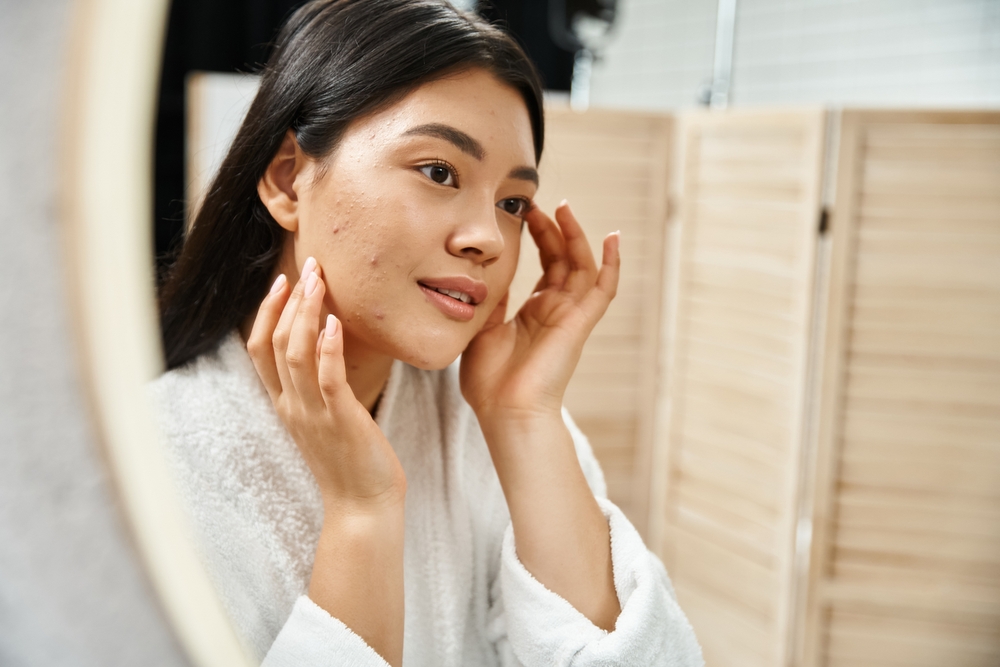 What Are the Longest Lasting Acne Facial Treatments in Merrifield VA?