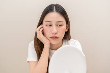 MOXI Laser Treatments in Merrifield, VA for Sun Damage and Skin Tone Improvement