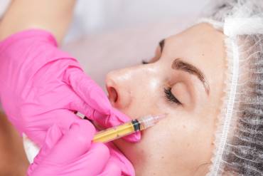 What You Need to Know About the Best Under Eye Filler Treatments in Dunn Loring, VA for Dark Circles and Hollow Eyes