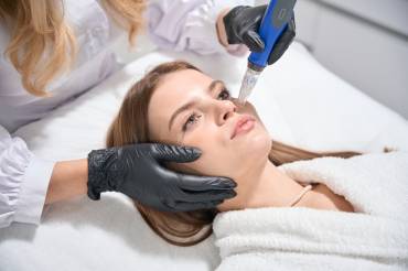 SkinPen for Acne Scars in Fairfax, VA: Is It Worth the Hype?