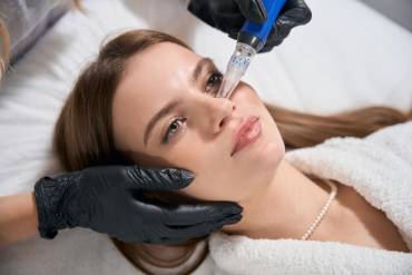Best SkinPen Microneedling in Fairfax, VA: What to Expect From Your Treatment