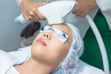 IPL Treatment Near Arlington & Falls Church VA