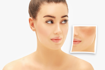 Pigmentation Near Arlington & Falls Church VA