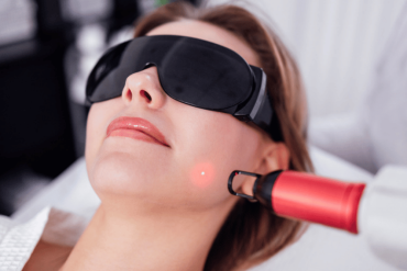 HALO Hybrid Fractional Laser in Fairfax VA
