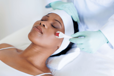 HALO Laser Skin Resurfacing Near Vienna VA